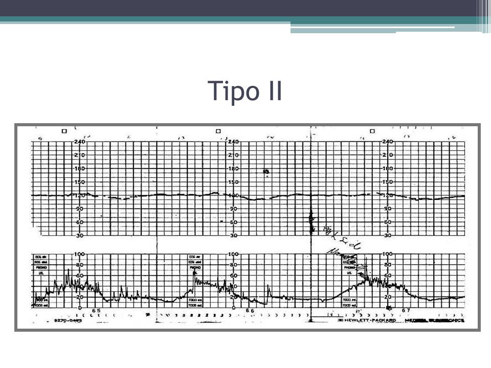 Registro Cardiotocografico Pdf Download